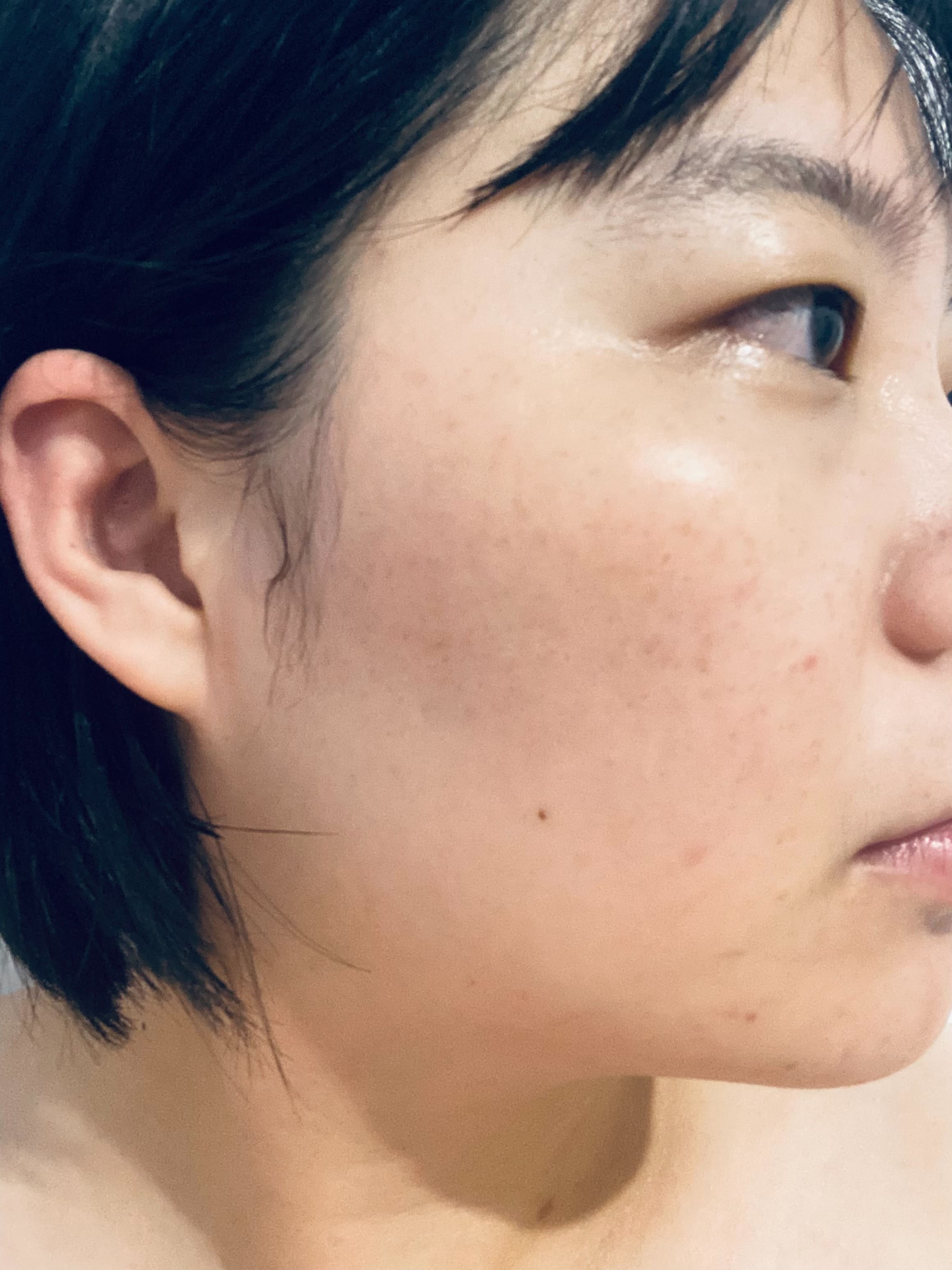 【修秘水光】皮膚真的變得很光滑，爸媽看到也驚訝我的臉變亮-Fen 